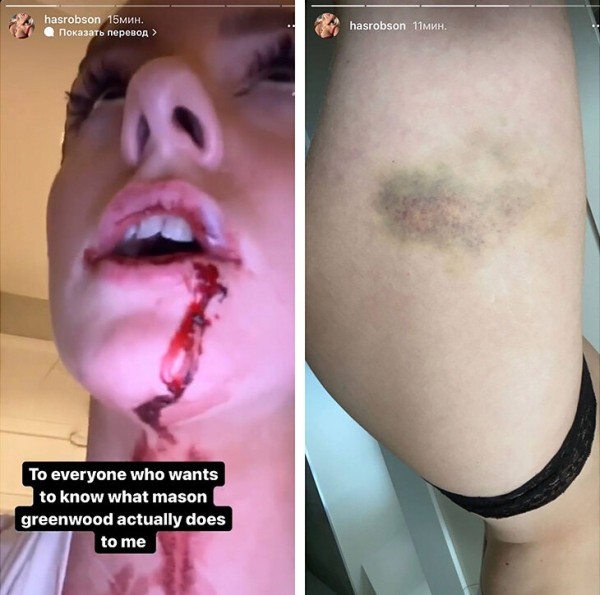 Хавбек «МЮ» попал за решетку – за него вступился экс-игрок Бреста: сомневается в потерпевшей (та говорит об изнасиловании), а еще не советует фильмы с гомосексуалами