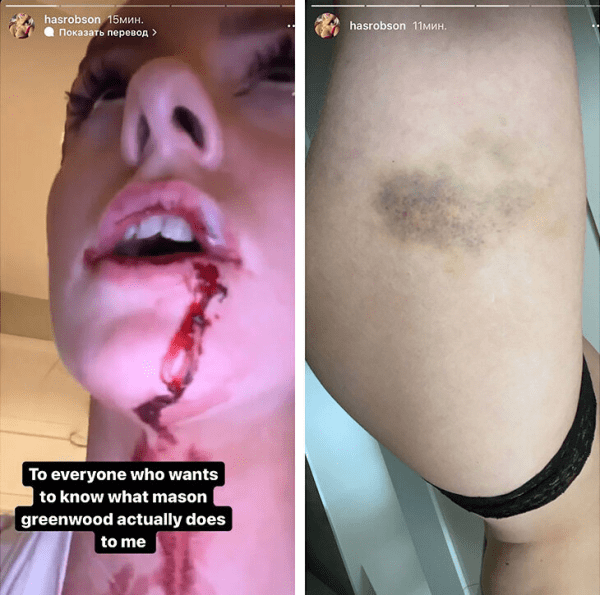 Угроза 7 лет тюрьмы и обыски: как дела у звезд АПЛ, которых подозревают в преступлениях? 