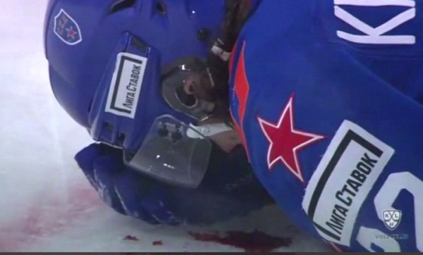 Хоккей. Наставник СКА Роман Ротенберг на отборном английском обматерил форварда минского "Динамо" Седрика Пакетта
Хоккей. Наставник СКА Роман Ротенберг на отборном английском обматерил форварда минского "Динамо" Седрика Пакетта