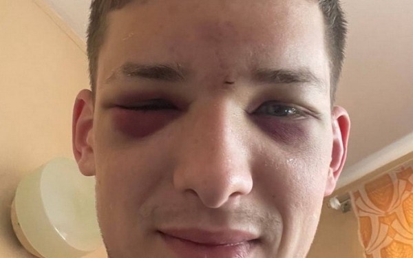 Футбол. Нападающий "Торпедо"-БелАЗа Дмитрий Вашкевич — о сотрясении мозга: вспышка, и все. Прыгнули с соперником
Футбол. Нападающий "Торпедо"-БелАЗа Дмитрий Вашкевич — о сотрясении мозга: вспышка, и все. Прыгнули с соперником